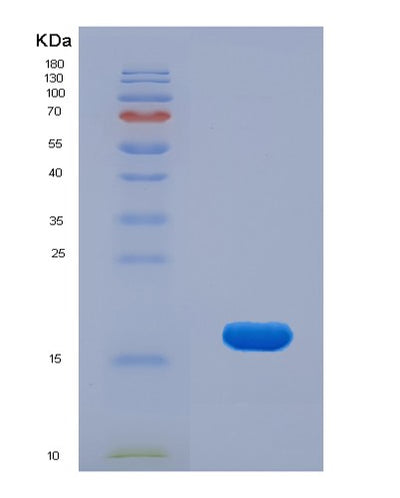 SDS-PAGE analysis of Human KLRB1 (Killer Cell Lectin-Like Receptor Subfamily B Member 1) - Recombinant Protein, CAT# BLT-01652P, showing >95% purity under 15% SDS-PAGE (Reduced)Human KLRB1 (Killer Cell Lectin-Like Receptor Subfamily B Member 1) - Recombinant Protein