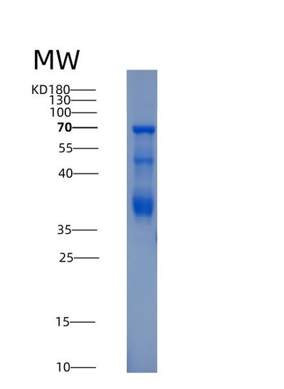 SDS-PAGE analysis of Human HTR1A (5-Hydroxytryptamine Receptor 1A) - Recombinant Protein, CAT# BLT-07155P, showing >80% purity under 15% SDS-PAGE (Reduced)Human HTR1A (5-Hydroxytryptamine Receptor 1A) - Recombinant Protein