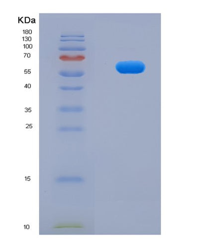 SDS-PAGE analysis of Human BNIP3 (Bcl2/Adenovirus E1B 19 Kda Protein-Interacting Protein 3) - Recombinant Protein, CAT# BLT-04833P, showing >95% purity under 15% SDS-PAGE (Reduced)Human BNIP3 (Bcl2/Adenovirus E1B 19 Kda Protein-Interacting Protein 3) - Recombinant Protein