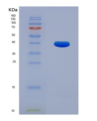 SDS-PAGE analysis of Human ECH1 (Delta(3,5)-Delta(2,4)-Dienoyl-Coa Isomerase, Mitochondrial) - Recombinant Protein, CAT# BLT-00920P, showing >85% purity under 15% SDS-PAGE (Reduced)Human ECH1 (Delta(3,5)-Delta(2,4)-Dienoyl-Coa Isomerase, Mitochondrial) - Recombinant Protein