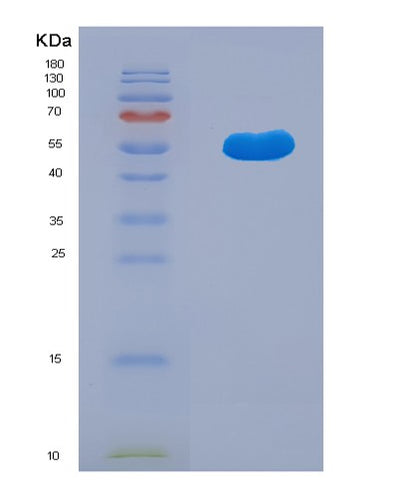 SDS-PAGE analysis of Human TRAF1 (Tnf Receptor-Associated Factor 1) - Recombinant Protein, CAT# BLT-03121P, showing >85% purity under 15% SDS-PAGE (Reduced)Human TRAF1 (Tnf Receptor-Associated Factor 1) - Recombinant Protein