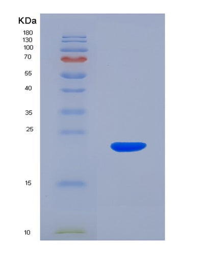 SDS-PAGE analysis of Human NME3 (Nucleoside Diphosphate Kinase 3) - Recombinant Protein, CAT# BLT-02039P, showing >90% purity under 15% SDS-PAGE (Reduced)Human NME3 (Nucleoside Diphosphate Kinase 3) - Recombinant Protein
