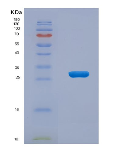 SDS-PAGE analysis of Human SLAMF1 (Signaling Lymphocytic Activation Molecule) - Recombinant Protein, CAT# BLT-02799P, showing >95% purity under 15% SDS-PAGE (Reduced)Human SLAMF1 (Signaling Lymphocytic Activation Molecule) - Recombinant Protein