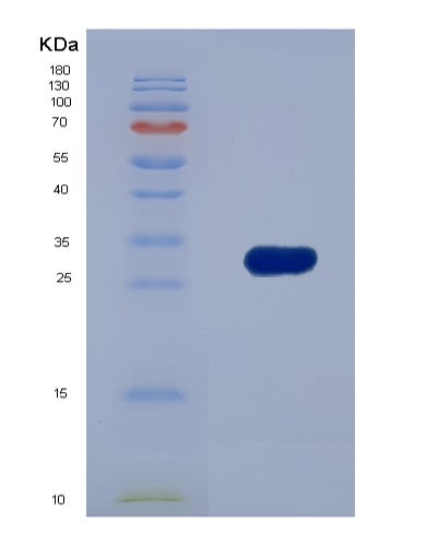 SDS-PAGE analysis of Human CTBP1 (C-Terminal-Binding Protein 1) - Recombinant Protein, CATHuman CTBP1 (C-Terminal-Binding Protein 1) - Recombinant Protein