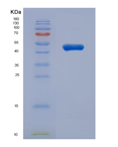 SDS-PAGE analysis of Human TUBB3 (Tubulin Beta-3 Chain) - Recombinant Protein, CAT# BLT-03158P, showing >95% purity under 15% SDS-PAGE (Reduced)Human TUBB3 (Tubulin Beta-3 Chain) - Recombinant Protein