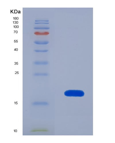 SDS-PAGE analysis of Human EIF4EBP1 (Eukaryotic Translation Initiation Factor 4E-Binding Protein 1) - Recombinant Protein, CAT# BLT-05411P, showing >90% purity under 15% SDS-PAGE (Reduced)Human EIF4EBP1 (Eukaryotic Translation Initiation Factor 4E-Binding Protein 1) - Recombinant Protein