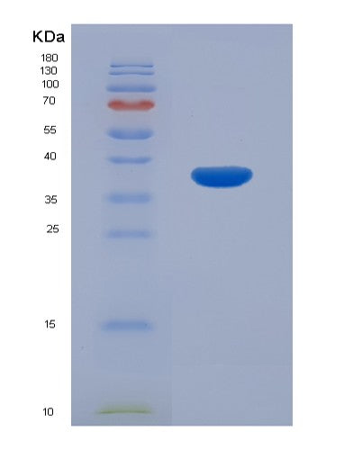 SDS-PAGE analysis of Human CAMK2B (Calcium/Calmodulin-Dependent Protein Kinase Type Ii Subunit Beta) - Recombinant Protein, CATHuman CAMK2B (Calcium/Calmodulin-Dependent Protein Kinase Type Ii Subunit Beta) - Recombinant Protein