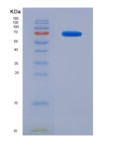 SDS-PAGE analysis of Human DLG4 (Disks Large Homolog 4) - Recombinant Protein, CAT# BLT-07711P, showing >90% purity under 15% SDS-PAGE (Reduced)Human DLG4 (Disks Large Homolog 4) - Recombinant Protein
