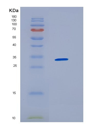 SDS-PAGE analysis of Human FGF2 (Fibroblast Growth Factor 2) - Recombinant Protein, CATHuman FGF2 (Fibroblast Growth Factor 2) - Recombinant Protein