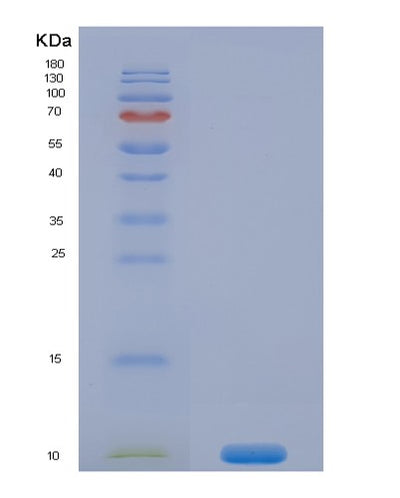 SDS-PAGE analysis of Mouse Ins1 (Insulin-1) - Recombinant Protein, CAT# BLT-08457P showing >90% purity under 15% SDS-PAGE (Reduced)Mouse Ins1 (Insulin-1) - Recombinant Protein
