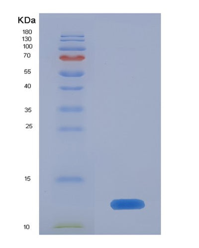 SDS-PAGE analysis of Human CD81 (Cd81 Antigen) - Recombinant Protein, CAT# BLT-07712P, showing >90% purity under 15% SDS-PAGE (Reduced)Human CD81 (Cd81 Antigen) - Recombinant Protein