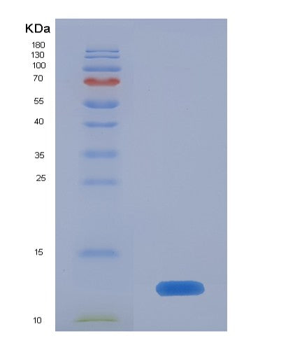 SDS-PAGE analysis of Human CD81 (Cd81 Antigen) - Recombinant Protein, CATHuman CD81 (Cd81 Antigen) - Recombinant Protein