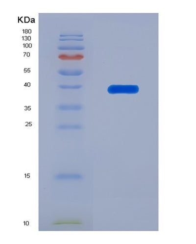 SDS-PAGE analysis of Human CD9 (Cd9 Antigen) - Recombinant Protein, CAT# BLT-07713P, showing >90% purity under 15% SDS-PAGE (Reduced)Human CD9 (Cd9 Antigen) - Recombinant Protein