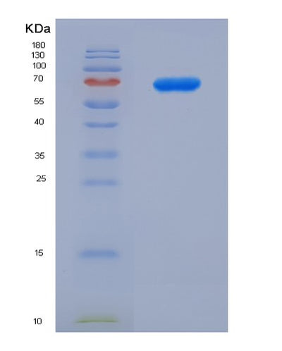 SDS-PAGE analysis of Human TDG (G/T Mismatch-Specific Thymine Dna Glycosylase) - Recombinant Protein, CAT# BLT-03002P, showing >90% purity under 15% SDS-PAGE (Reduced)Human TDG (G/T Mismatch-Specific Thymine Dna Glycosylase) - Recombinant Protein