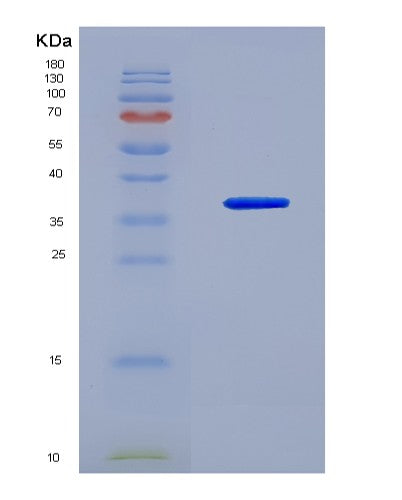SDS-PAGE analysis of Human DYRK1A (Dual Specificity Tyrosine-Phosphorylation-Regulated Kinase 1A) - Recombinant Protein, CATHuman DYRK1A (Dual Specificity Tyrosine-Phosphorylation-Regulated Kinase 1A) - Recombinant Protein