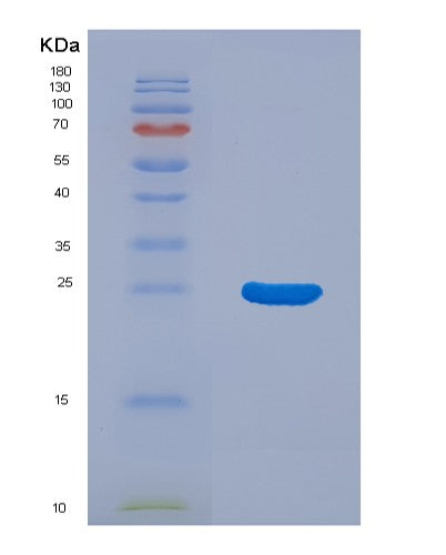 SDS-PAGE analysis of Human LGALS3BP (Galectin-3-Binding Protein) - Recombinant Protein, CATHuman LGALS3BP (Galectin-3-Binding Protein) - Recombinant Protein