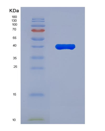 SDS-PAGE analysis of Human AUH (Methylglutaconyl-Coa Hydratase, Mitochondrial) - Recombinant Protein, CAT# BLT-00269P, showing >85% purity under 15% SDS-PAGE (Reduced)Human AUH (Methylglutaconyl-Coa Hydratase, Mitochondrial) - Recombinant Protein