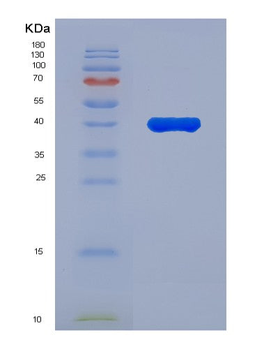 SDS-PAGE analysis of Human AUH (Methylglutaconyl-Coa Hydratase, Mitochondrial) - Recombinant Protein, CATHuman AUH (Methylglutaconyl-Coa Hydratase, Mitochondrial) - Recombinant Protein