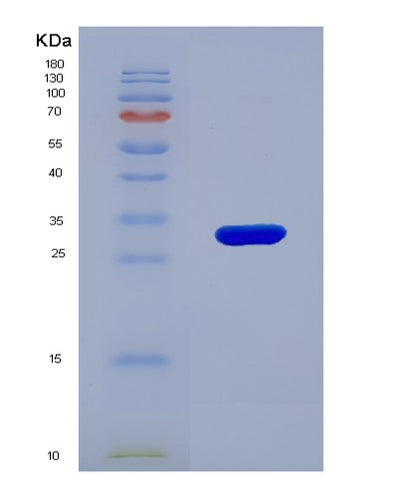 SDS-PAGE analysis of Human BLMH (Bleomycin Hydrolase) - Recombinant Protein, CAT# BLT-00331P, showing >95% purity under 15% SDS-PAGE (Reduced)Human BLMH (Bleomycin Hydrolase) - Recombinant Protein