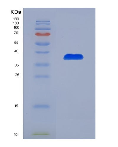 SDS-PAGE analysis of Human ICA1 (Islet Cell Autoantigen 1) - Recombinant Protein, CAT# BLT-07717P, showing >90% purity under 15% SDS-PAGE (Reduced)Human ICA1 (Islet Cell Autoantigen 1) - Recombinant Protein
