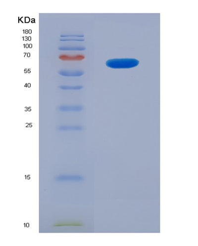 SDS-PAGE analysis of Human GAD1 (Glutamate Decarboxylase 1) - Recombinant Protein, CAT# BLT-07718P, showing >90% purity under 15% SDS-PAGE (Reduced)Human GAD1 (Glutamate Decarboxylase 1) - Recombinant Protein