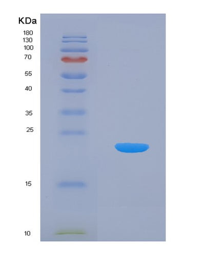 SDS-PAGE analysis of Human CIRBP (Cold-Inducible Rna-Binding Protein) - Recombinant Protein, CAT# BLT-00608P, showing >95% purity under 15% SDS-PAGE (Reduced)Human CIRBP (Cold-Inducible Rna-Binding Protein) - Recombinant Protein