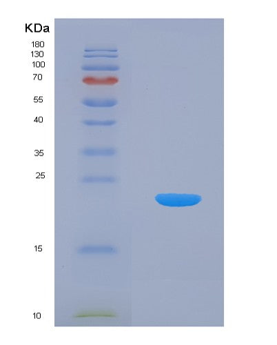 SDS-PAGE analysis of Human CIRBP (Cold-Inducible Rna-Binding Protein) - Recombinant Protein, CATHuman CIRBP (Cold-Inducible Rna-Binding Protein) - Recombinant Protein