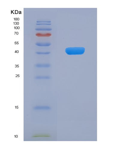 SDS-PAGE analysis of Human CAMK1 (Calcium/Calmodulin-Dependent Protein Kinase Type 1) - Recombinant Protein, CAT# BLT-06326P, showing >90% purity under 15% SDS-PAGE (Reduced)Human CAMK1 (Calcium/Calmodulin-Dependent Protein Kinase Type 1) - Recombinant Protein
