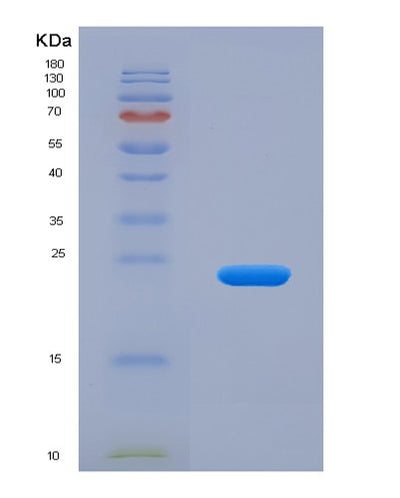 SDS-PAGE analysis of Human GAMT (Guanidinoacetate N-Methyltransferase) - Recombinant Protein, CAT# BLT-01151P, showing >95% purity under 15% SDS-PAGE (Reduced)Human GAMT (Guanidinoacetate N-Methyltransferase) - Recombinant Protein