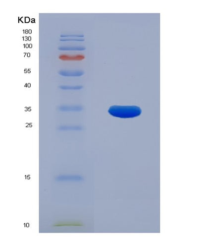 SDS-PAGE analysis of Human BECN1 (Beclin-1) - Recombinant Protein, CAT# BLT-00312P, showing >95% purity under 15% SDS-PAGE (Reduced)Human BECN1 (Beclin-1) - Recombinant Protein