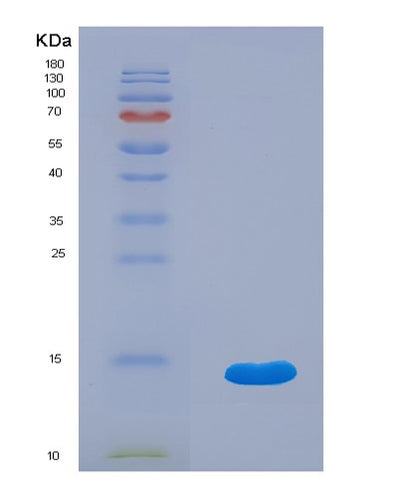 SDS-PAGE analysis of Human IL13RA2 (Interleukin-13 Receptor Subunit Alpha-2) - Recombinant Protein, CAT# BLT-01518P, showing >90% purity under 15% SDS-PAGE (Reduced)Human IL13RA2 (Interleukin-13 Receptor Subunit Alpha-2) - Recombinant Protein