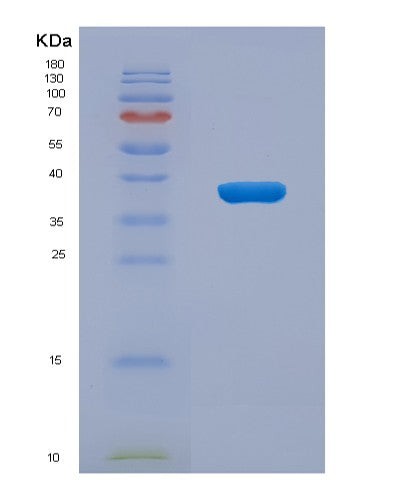 SDS-PAGE analysis of Human LASP1 (Lim And Sh3 Domain Protein 1) - Recombinant Protein, CATHuman LASP1 (Lim And Sh3 Domain Protein 1) - Recombinant Protein