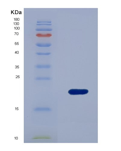 SDS-PAGE analysis of Human WTAP (Pre-Mrna-Splicing Regulator Wtap) - Recombinant Protein, CATHuman WTAP (Pre-Mrna-Splicing Regulator Wtap) - Recombinant Protein