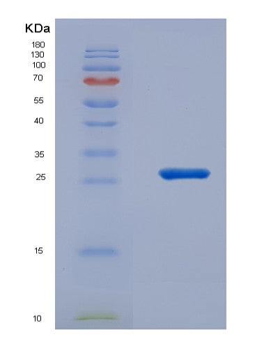 SDS-PAGE analysis of Human NCF4 (Neutrophil Cytosol Factor 4) - Recombinant Protein, CATHuman NCF4 (Neutrophil Cytosol Factor 4) - Recombinant Protein