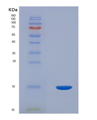 SDS-PAGE analysis of Human PCOLCE (Procollagen C-Endopeptidase Enhancer 1) - Recombinant Protein, CAT# BLT-02174P, showing >85% purity under 15% SDS-PAGE (Reduced)Human PCOLCE (Procollagen C-Endopeptidase Enhancer 1) - Recombinant Protein