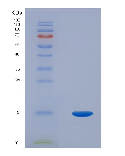 SDS-PAGE analysis of Human PCOLCE (Procollagen C-Endopeptidase Enhancer 1) - Recombinant Protein, CATHuman PCOLCE (Procollagen C-Endopeptidase Enhancer 1) - Recombinant Protein