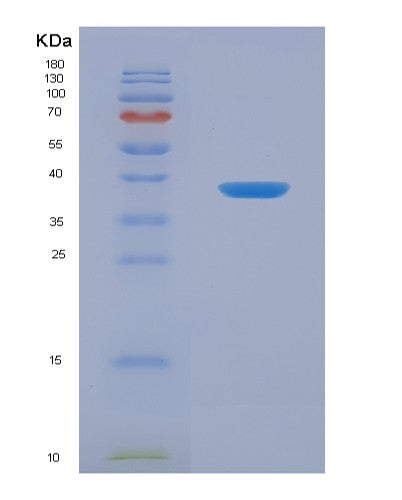 SDS-PAGE analysis of Human ANKRD1 (Ankyrin Repeat Domain-Containing Protein 1) - Recombinant Protein, CATHuman ANKRD1 (Ankyrin Repeat Domain-Containing Protein 1) - Recombinant Protein