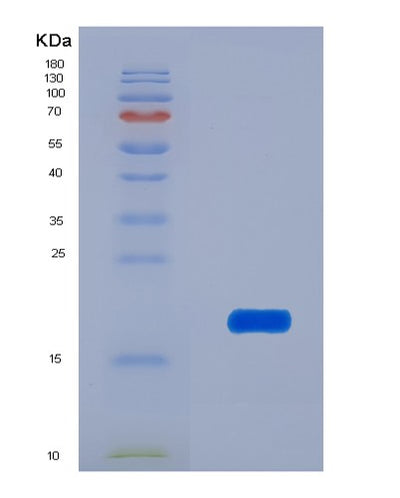 SDS-PAGE analysis of Human ANGPT1 (Angiopoietin-1) - Recombinant Protein, CAT# BLT-00152P, showing >90% purity under 15% SDS-PAGE (Reduced)Human ANGPT1 (Angiopoietin-1) - Recombinant Protein