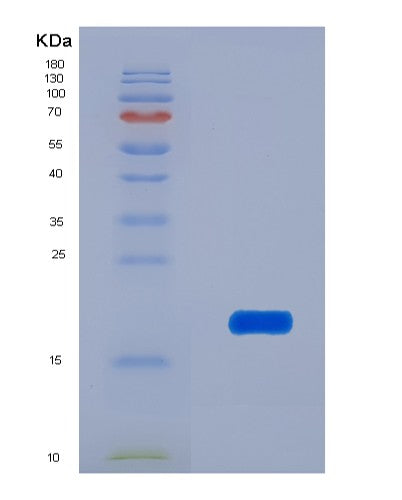 SDS-PAGE analysis of Human ANGPT1 (Angiopoietin-1) - Recombinant Protein, CATHuman ANGPT1 (Angiopoietin-1) - Recombinant Protein