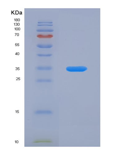 SDS-PAGE analysis of Human RSU1 (Ras Suppressor Protein 1) - Recombinant Protein, CAT# BLT-02651P, showing >95% purity under 15% SDS-PAGE (Reduced)Human RSU1 (Ras Suppressor Protein 1) - Recombinant Protein