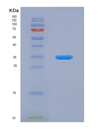 SDS-PAGE analysis of Human RSU1 (Ras Suppressor Protein 1) - Recombinant Protein, CATHuman RSU1 (Ras Suppressor Protein 1) - Recombinant Protein