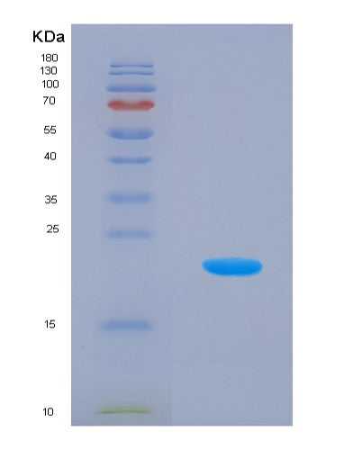 SDS-PAGE analysis of Human SHH (Sonic Hedgehog Protein) - Recombinant Protein, CATHuman SHH (Sonic Hedgehog Protein) - Recombinant Protein