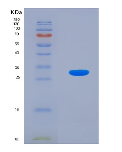 SDS-PAGE analysis of Human RGN (Regucalcin) - Recombinant Protein, CAT# BLT-02567P, showing >90% purity under 15% SDS-PAGE (Reduced)Human RGN (Regucalcin) - Recombinant Protein