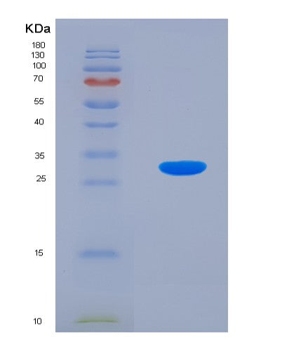 SDS-PAGE analysis of Human RGN (Regucalcin) - Recombinant Protein, CATHuman RGN (Regucalcin) - Recombinant Protein