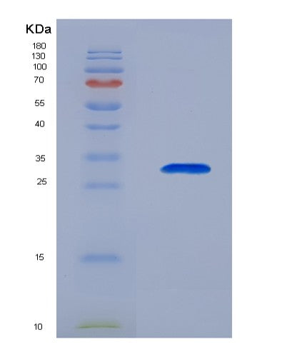 SDS-PAGE analysis of Human TCEA2 (Transcription Elongation Factor A Protein 2) - Recombinant Protein, CATHuman TCEA2 (Transcription Elongation Factor A Protein 2) - Recombinant Protein