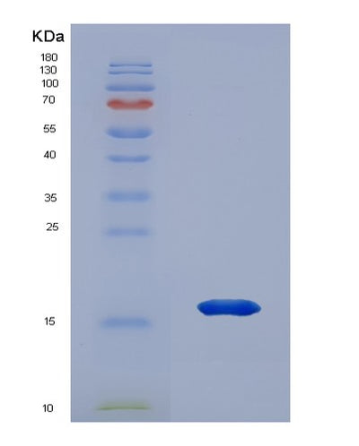 SDS-PAGE analysis of Human HMGN3 (High Mobility Group Nucleosome-Binding Domain-Containing Protein 3) - Recombinant Protein, CAT# BLT-01391P, showing >95% purity under 15% SDS-PAGE (Reduced)Human HMGN3 (High Mobility Group Nucleosome-Binding Domain-Containing Protein 3) - Recombinant Protein