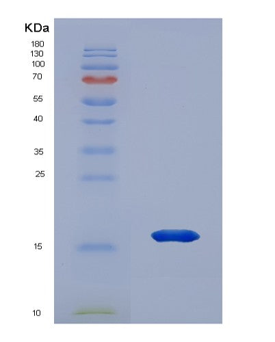 SDS-PAGE analysis of Human HMGN3 (High Mobility Group Nucleosome-Binding Domain-Containing Protein 3) - Recombinant Protein, CATHuman HMGN3 (High Mobility Group Nucleosome-Binding Domain-Containing Protein 3) - Recombinant Protein