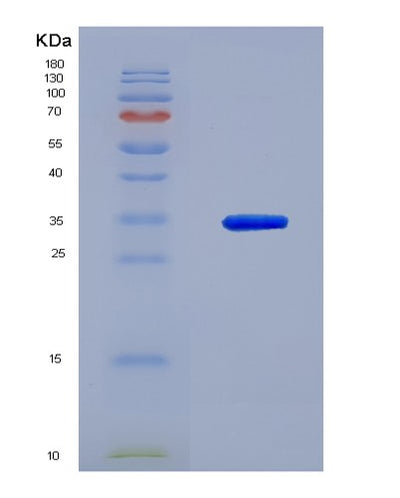 SDS-PAGE analysis of Human NFKBIB (Nf-Kappa-B Inhibitor Beta) - Recombinant Protein, CAT# BLT-02020P, showing >90% purity under 15% SDS-PAGE (Reduced)Human NFKBIB (Nf-Kappa-B Inhibitor Beta) - Recombinant Protein