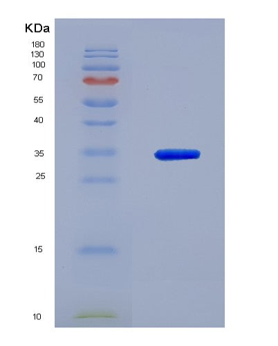 SDS-PAGE analysis of Human NFKBIB (Nf-Kappa-B Inhibitor Beta) - Recombinant Protein, CATHuman NFKBIB (Nf-Kappa-B Inhibitor Beta) - Recombinant Protein