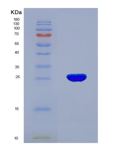 SDS-PAGE analysis of Human TPSAB1 (Tryptase Alpha/Beta-1) - Recombinant Protein, CAT# BLT-03115P, showing >90% purity under 15% SDS-PAGE (Reduced)Human TPSAB1 (Tryptase Alpha/Beta-1) - Recombinant Protein